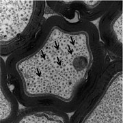Microtubule density in untreated tau mice